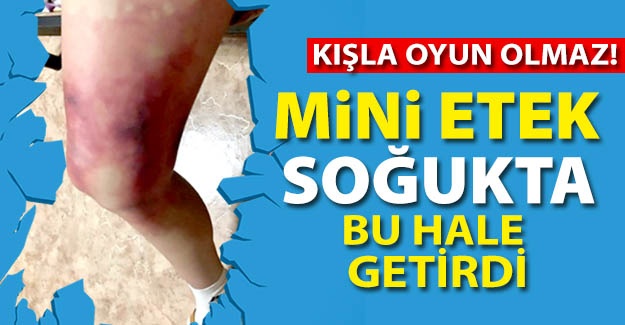 Mini etek bu hale getirdi!