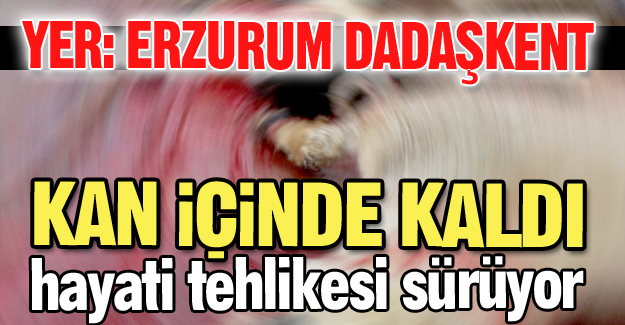 Kanlar içinde kaldı!