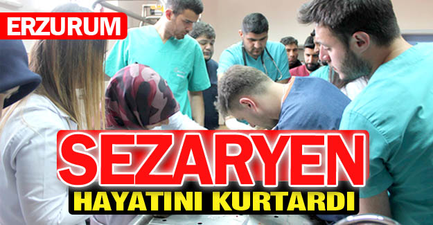 Hayatını sezaryen kurtardı!