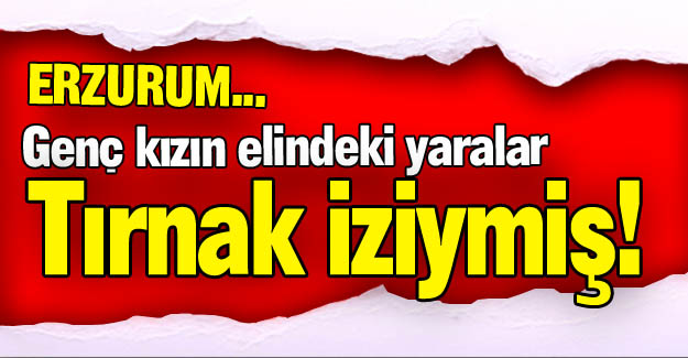 O yaralar tırnak iziymiş!
