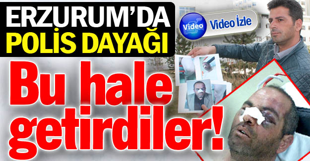Erzurum'da öldüresiye polis dayağı!