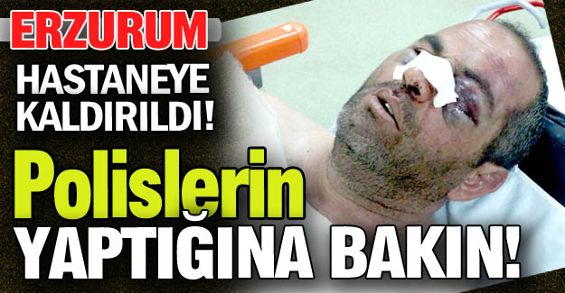 Erzurum'da vatandaşa polis dayağı!