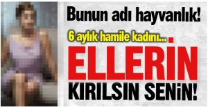 Ellerin kırılsın!