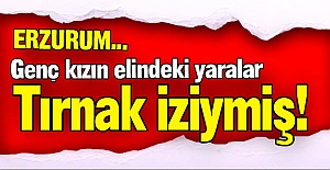 O yaralar tırnak iziymiş!